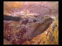 ADHESIONS BOWELS OMENTAL9 ADHESIONS BOWELS OMENTAL9